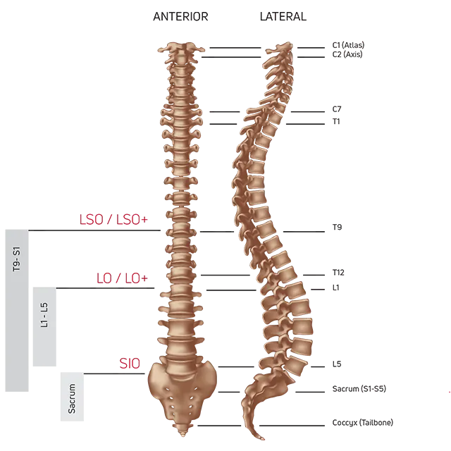 DONJOY ISO Form SIO Back Brace
